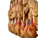 Schinken
